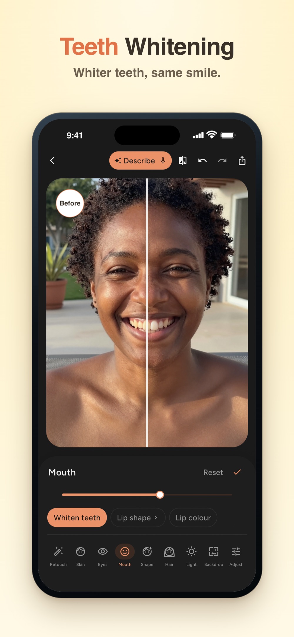 FaceMend: Teeth Whitening